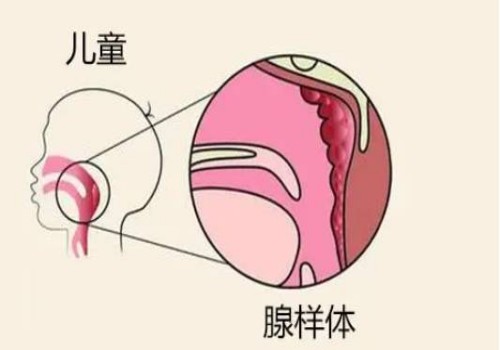 剖腹产后上面多长一层肉是什么原因，剖腹产后上面多长一层肉怎么办