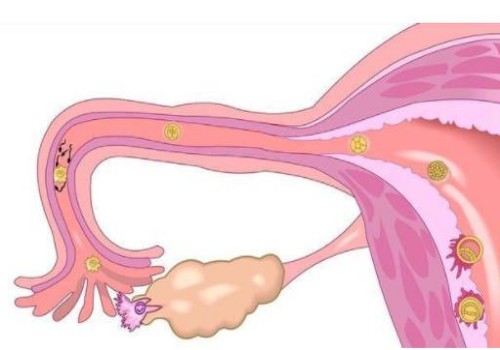 母乳性黄疸的早期症状！看完这篇你就了解了